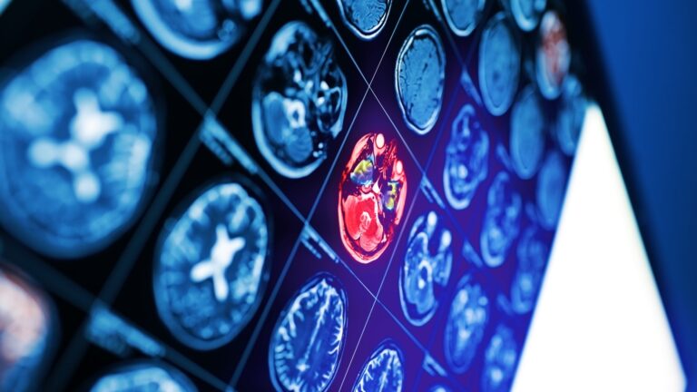 Diagnostica per immagini: stato dell’arte, software e soluzioni