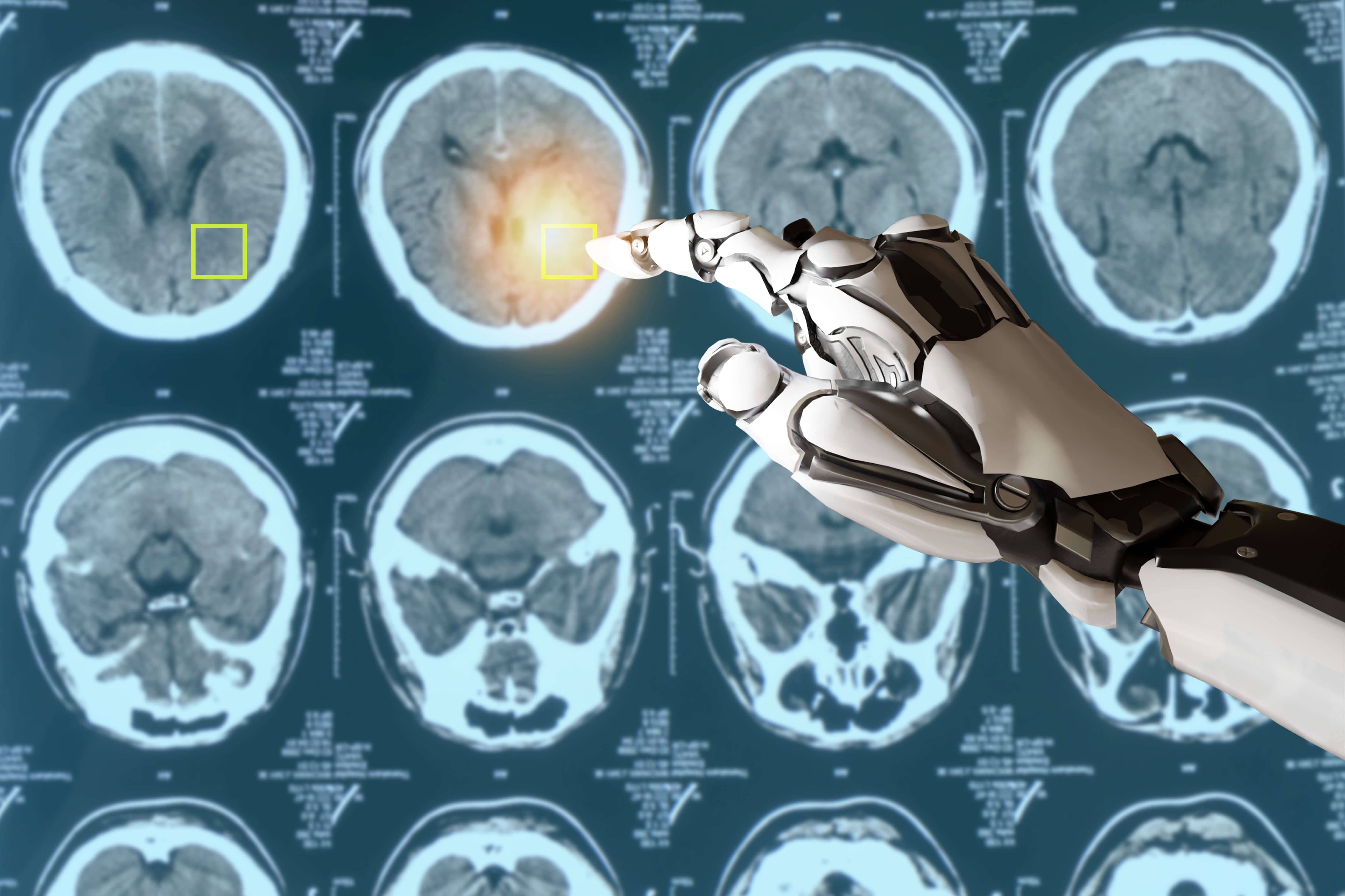 l'intelligenza artificiale nella lotta ai tumori