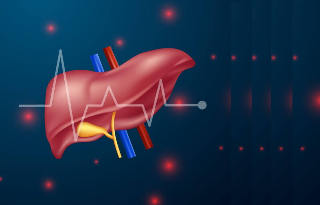 epatite C e intelligenza artificiale