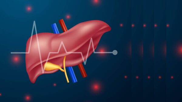 epatite C e intelligenza artificiale